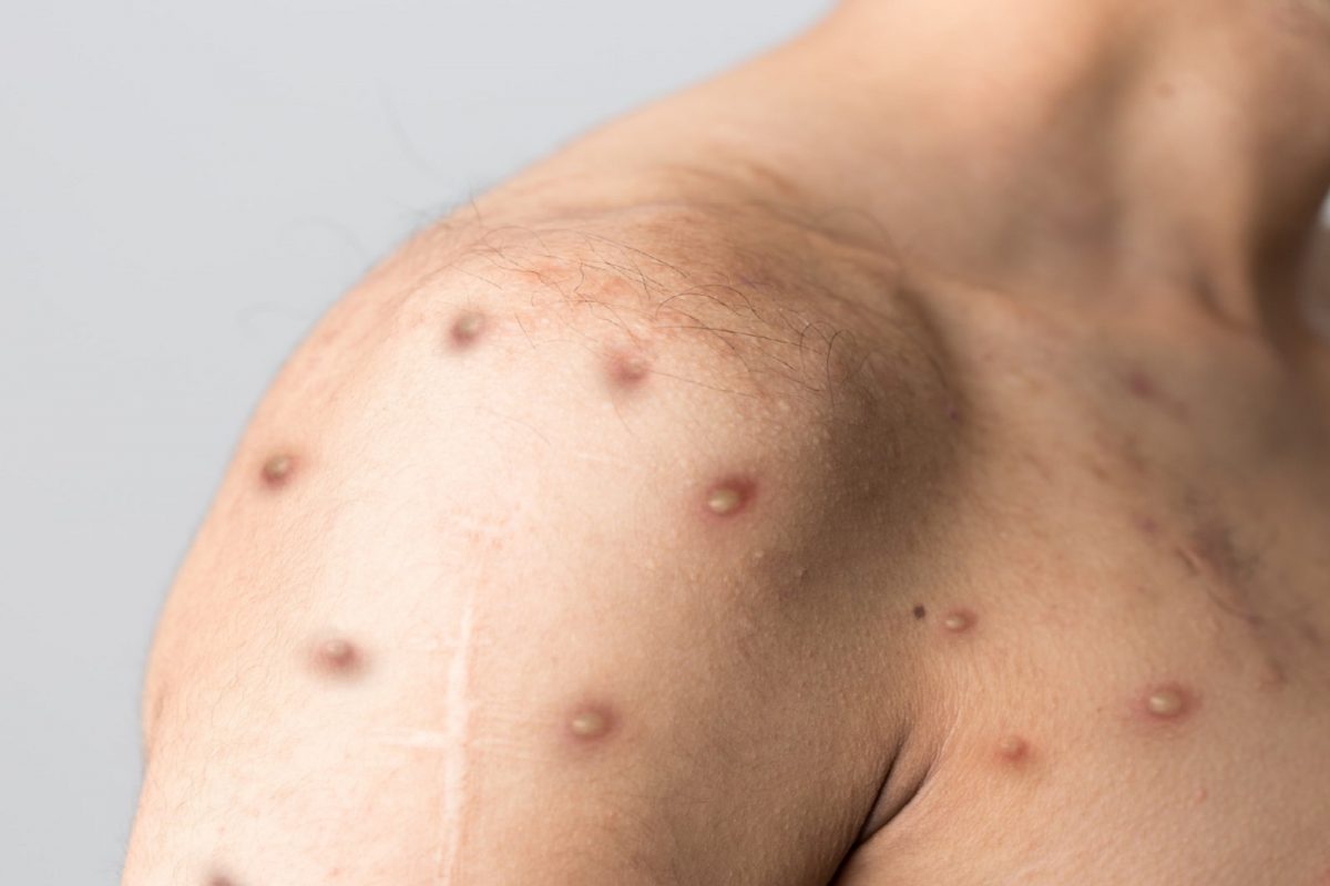 प्रतीकात्मक फोटो (सौजन्य - Shutterstock)