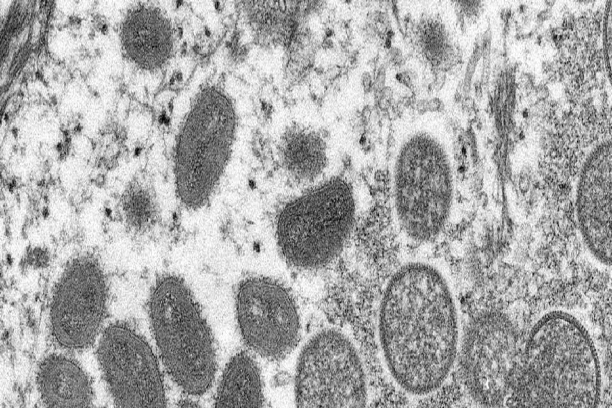 जिथं याआधी कधीच घुसू शकला नाही त्या देशातही Monkyepox Virus चा शिरकाव; भारताला किती धोका?