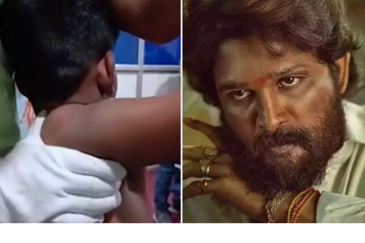 दररोजच्या शाळेमुळे 11 वर्षांचा मुलगा झाला 'पुष्पा'; दीड महिन्यांनी आला ठिकाण्यावर...