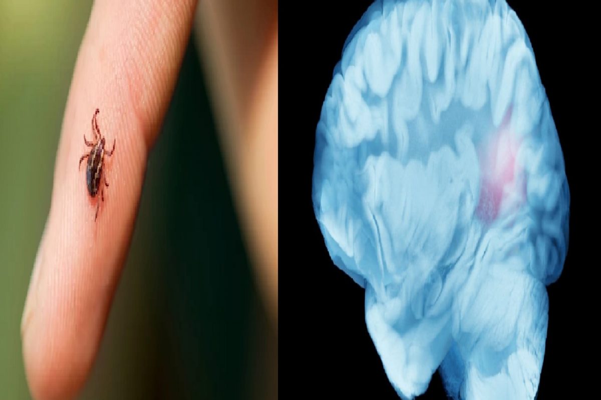 प्रतीकात्मक फोटो (सौजन्य - Canva)