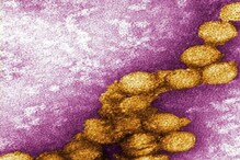 भारतात कोरोनानंतर आता West Nile Fever चा बळी; कसा होतो हा आजार, लक्षणं काय? भारतात कोरोनानंतर आता West Nile Fever चा बळी; कसा होतो हा आजार, लक्षणं काय?