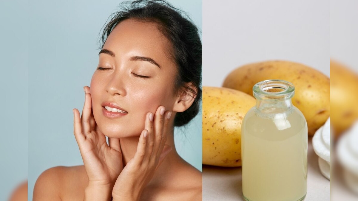 Potato juice for skin care and beauty benefits rp पिंपल्स, काळे डाग
