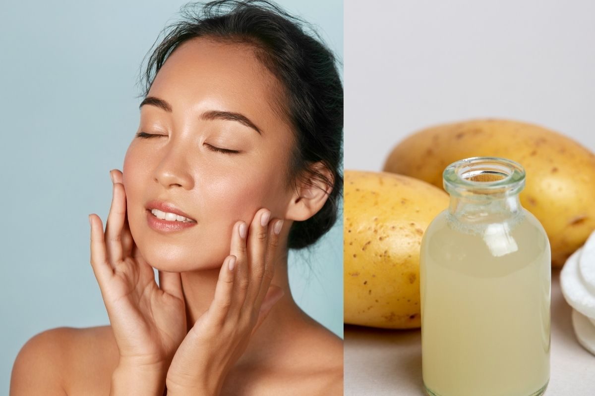 पिंपल्स, काळे डाग घालवण्यासाठी बटाट्याचा रस आहे फायदेशीर; असा करा घरच्या-घरी वापर