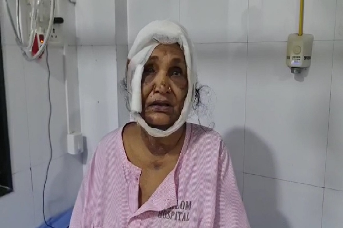 75 वर्षीय वृद्धेवर जीवघेणा हल्ला, महिलेच्या अंगावर पडले तब्बल 56 टाके