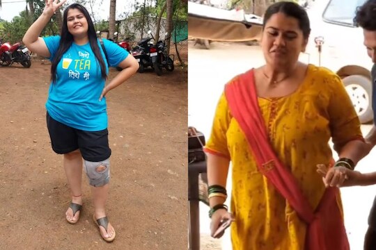 मालिकेच्या सेटवर अभिनेत्री अक्षया नाईकच्या पायाला दुखापत, दोन पावलं चालणंही झालं कठीण 
