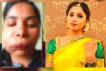 चुकीच्या रूट कॅनॉलनं लागली अभिनेत्रीच्या चेहऱ्याची वाट; आता ओळखणंही झालंय कठीण चुकीच्या रूट कॅनॉलनं लागली अभिनेत्रीच्या चेहऱ्याची वाट; आता ओळखणंही झालंय कठीण