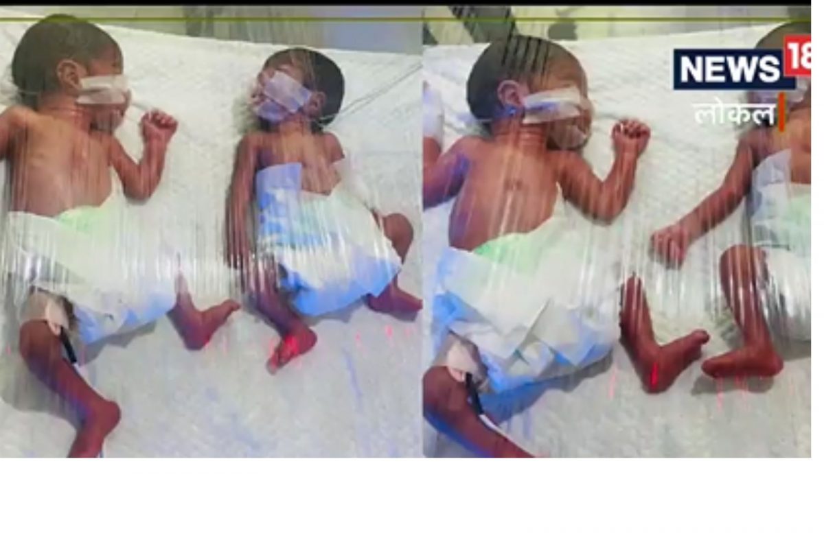 मुलगाच हवा या अट्टाहासापायी रिक्षाचालक झाला 7 मुलांचा बाप, पत्नीनं दिला एकाचवेळी 4 मुलांना जन्म