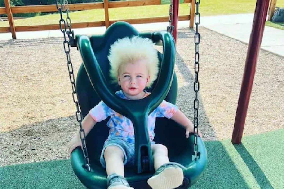 पालक विंचरून विंचरून थकले तरी चिमुकल्याचे केस उभे ते उभेच; डॉक्टरांनी सांगितलं धक्कादायक कारण