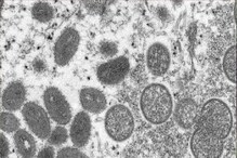 अरे देवा! कोरोनानंतर आता Anthrax ची दहशत; कित्येक बळी घेतल्याने खळबळ अरे देवा! कोरोनानंतर आता Anthrax ची दहशत; कित्येक बळी घेतल्याने खळबळ