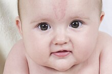 Birthmark: जन्मजात शरीरावरील खुणांचे असते विशेष महत्व; म्हणून लकी ठरतात ही माणसं Birthmark: जन्मजात शरीरावरील खुणांचे असते विशेष महत्व; म्हणून लकी ठरतात ही माणसं