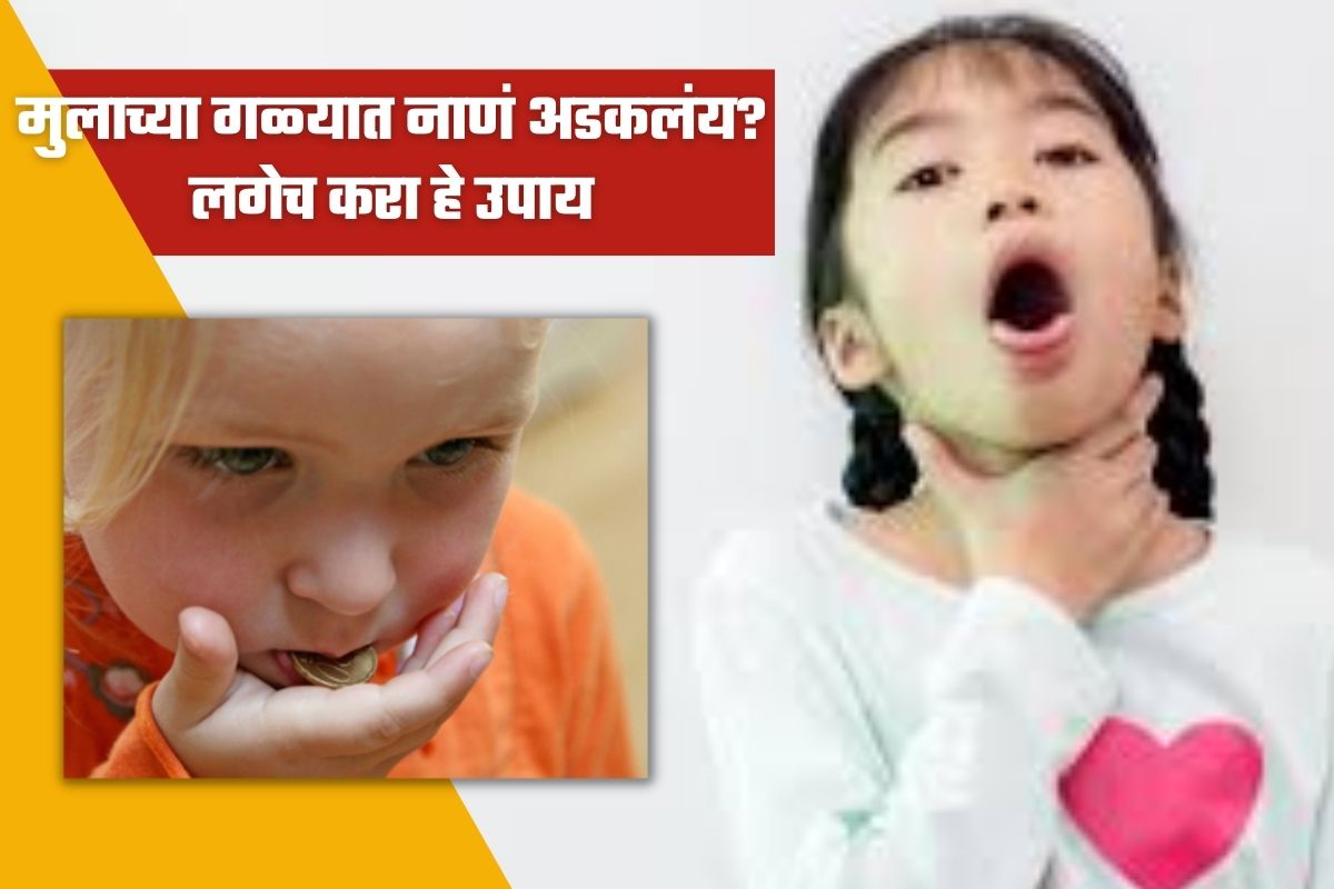 मुलाच्या गळ्यात नाणं अडकलंय? लगेच करा हे उपाय, नाहीतर...