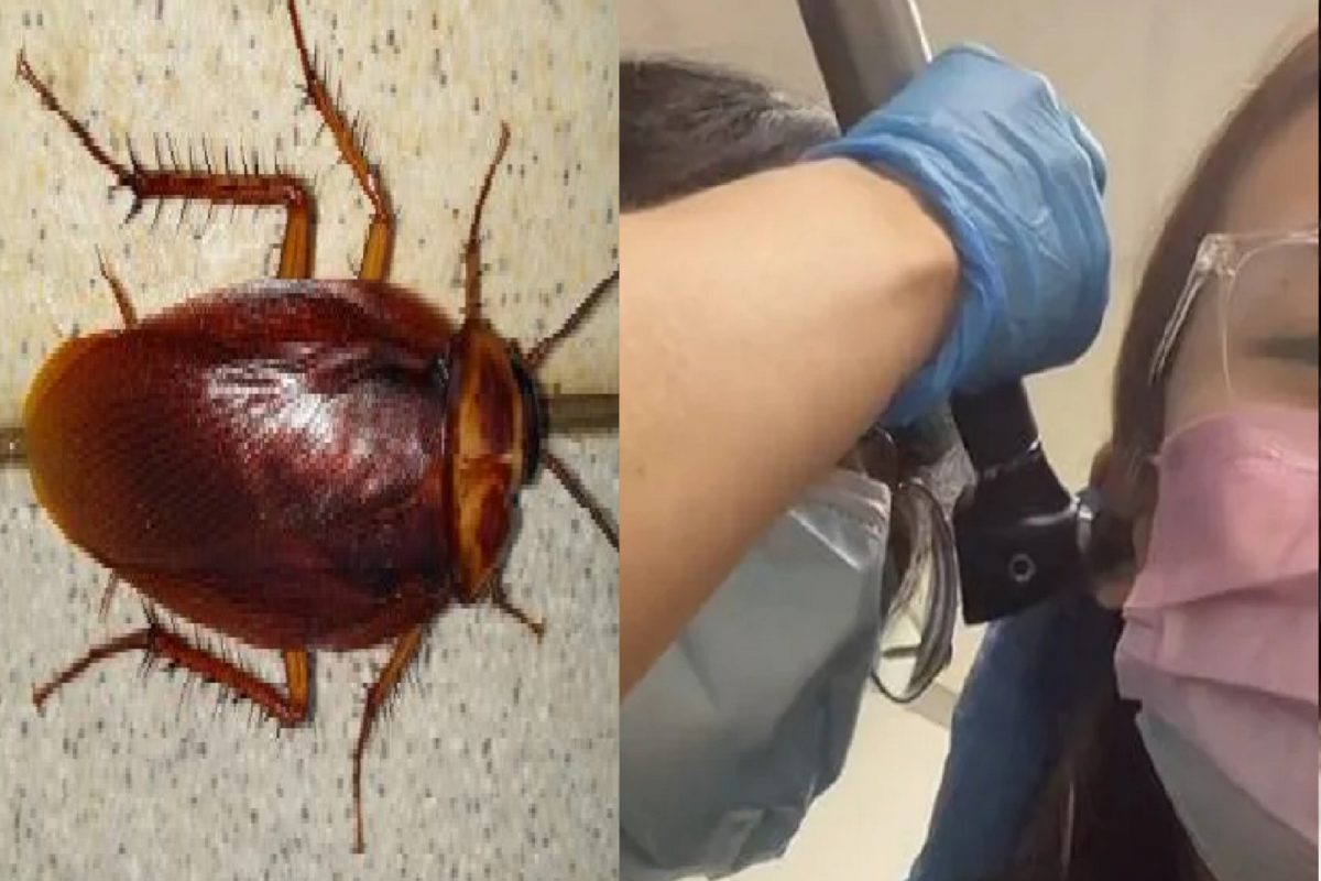 Cockroach in Ear : कानात घुसलं झुरळ, महिलेने घाईघाईत माऊथवॉश ओतलं; अशी अवस्था झाली की रुग्णालयात पोहोचली