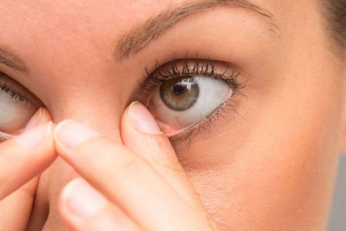 World Sight Day 2022: डोळ्यात घाण/किडा गेल्यावर लगेच काय करावं? अनेकजण करतात ती चूक टाळा