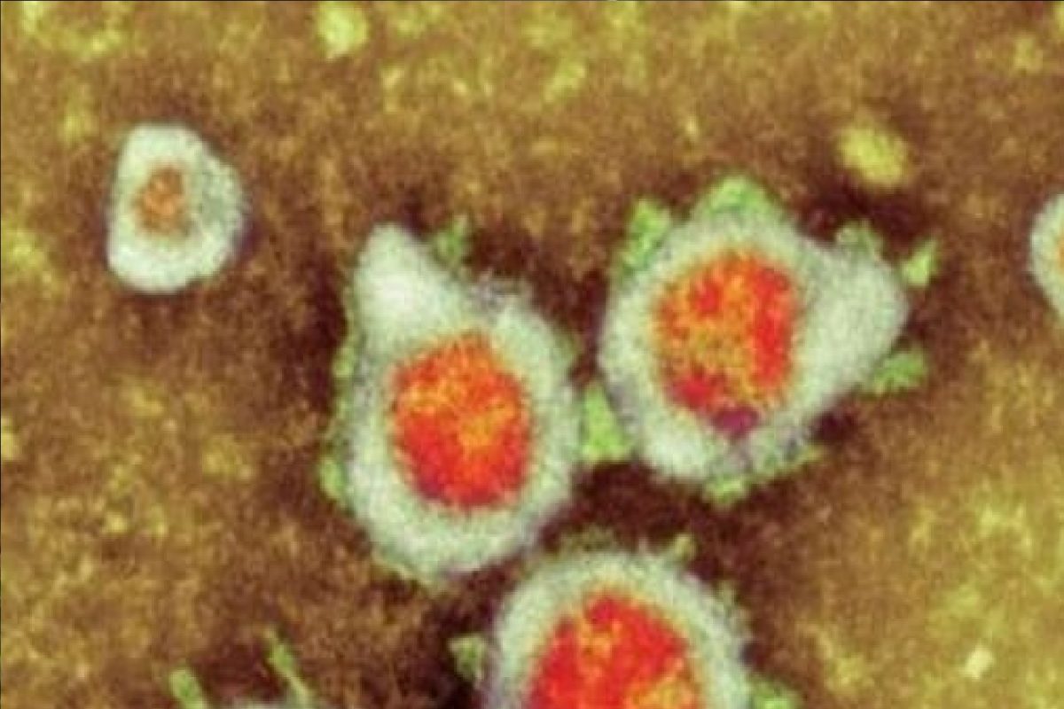 Corona, Monkeypox पेक्षाही भयंकर Marburg virus! उपचारालाही वेळ मिळाला नाही, रुग्णालयात दाखल होताच 2 रुग्णांचा बळी