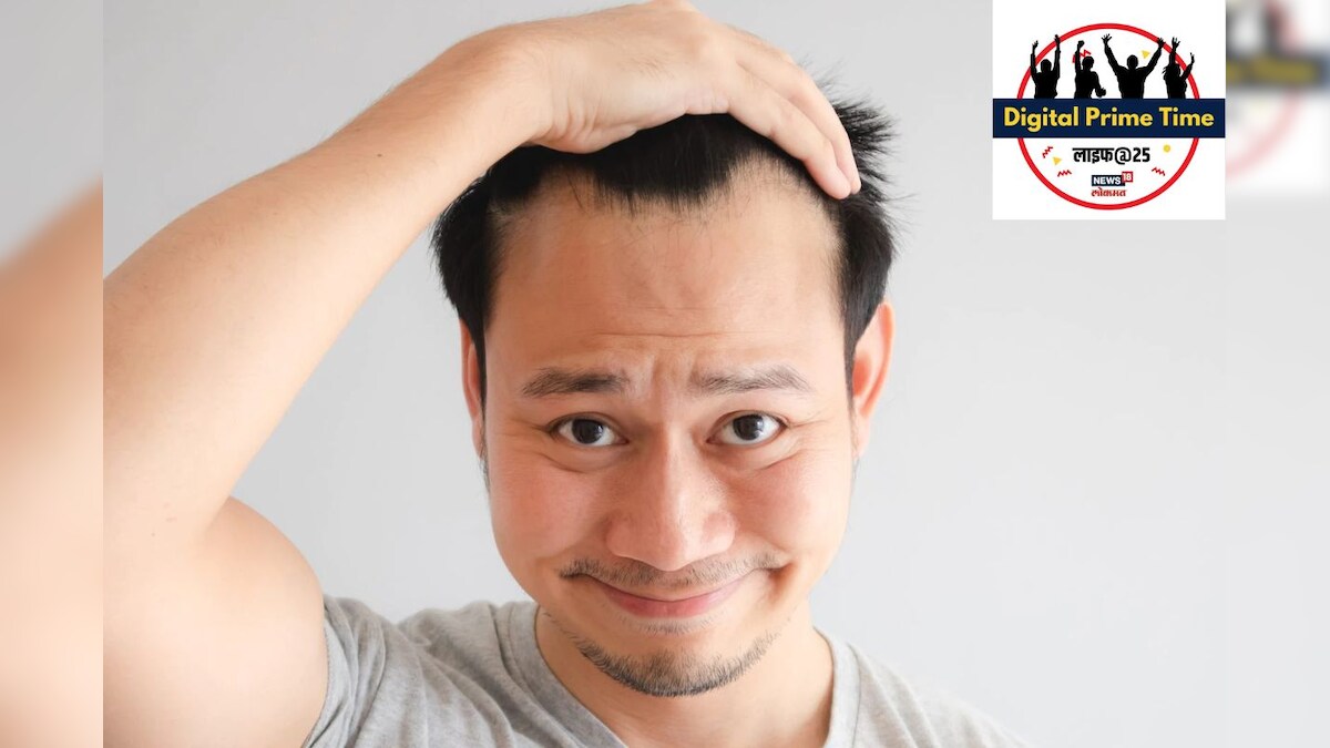 How To Prevent Hair Loss In Men Men Should Follow These Tips To