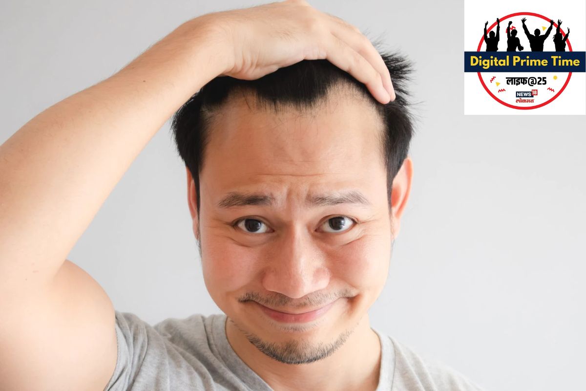 Prevent Hair Loss In Men : पुरुषांनी फॉलो करा या टिप्स, केसगळतीपासून होईल बचाव