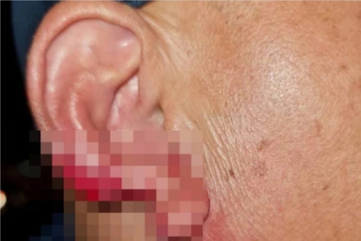 रोमान्स करताना तरुणीने चावला त्याचा कान. (फोटो सौजन्य - Viral Press)