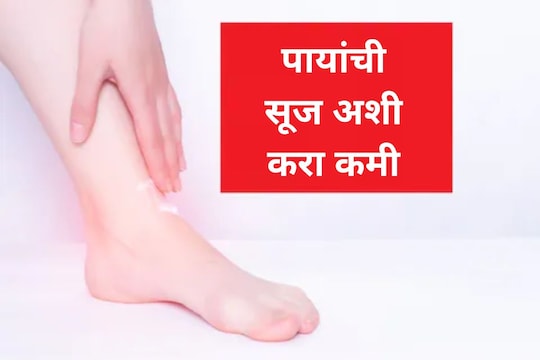 पायांची सूज अशी करा कमी 