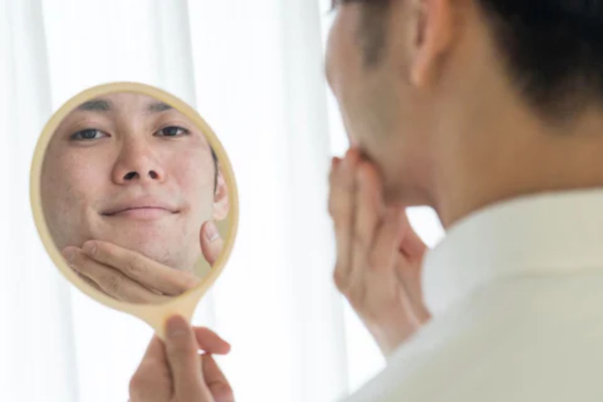 या व्हिटॅमिनच्या कमतरतेमुळं तरुणांच्या चेहऱ्यावर येतात पिंपल्स, ही आहेत इतर कारणे