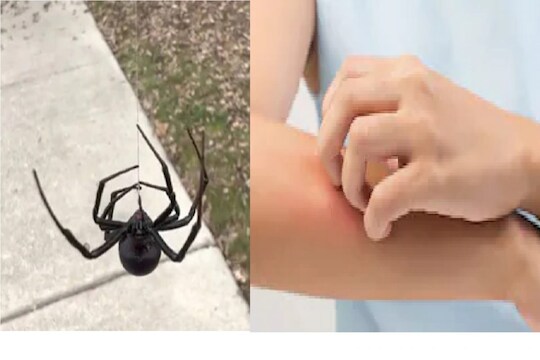 कोळी चावल्याने महिलेची भयानक अवस्था (प्रतीकात्मक फोटो)