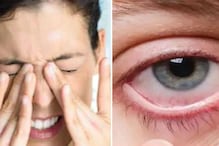 Vitamin A Deficiency : व्हिटॅमिन Aच्या कमतरतेचे डोळ्यांवर होऊ शकतात गंभीर परिणाम, ही आहेत लक्षणे