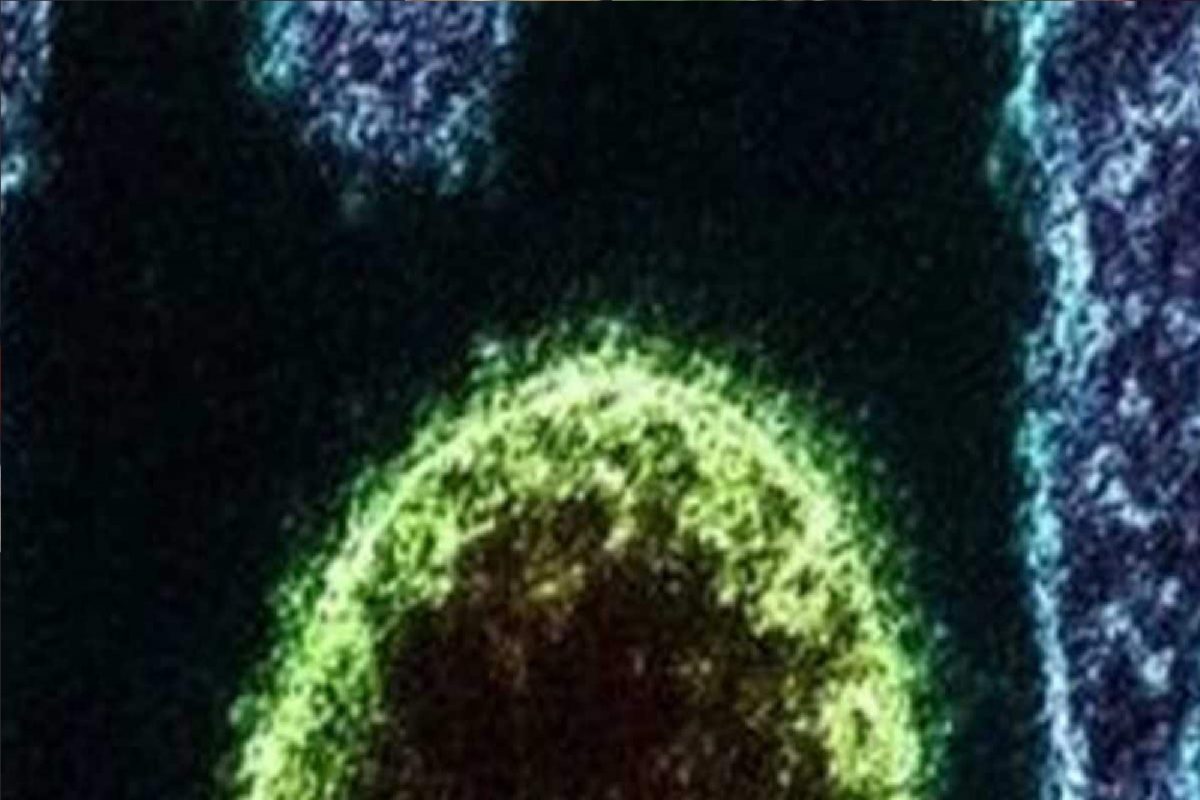 Zoonotic lagnya Virus : कोरोना, मंकीपॉक्सनंतर आता लँग्या व्हायरस; 35 रुग्ण आढळले, अशी आहेत लक्षणं