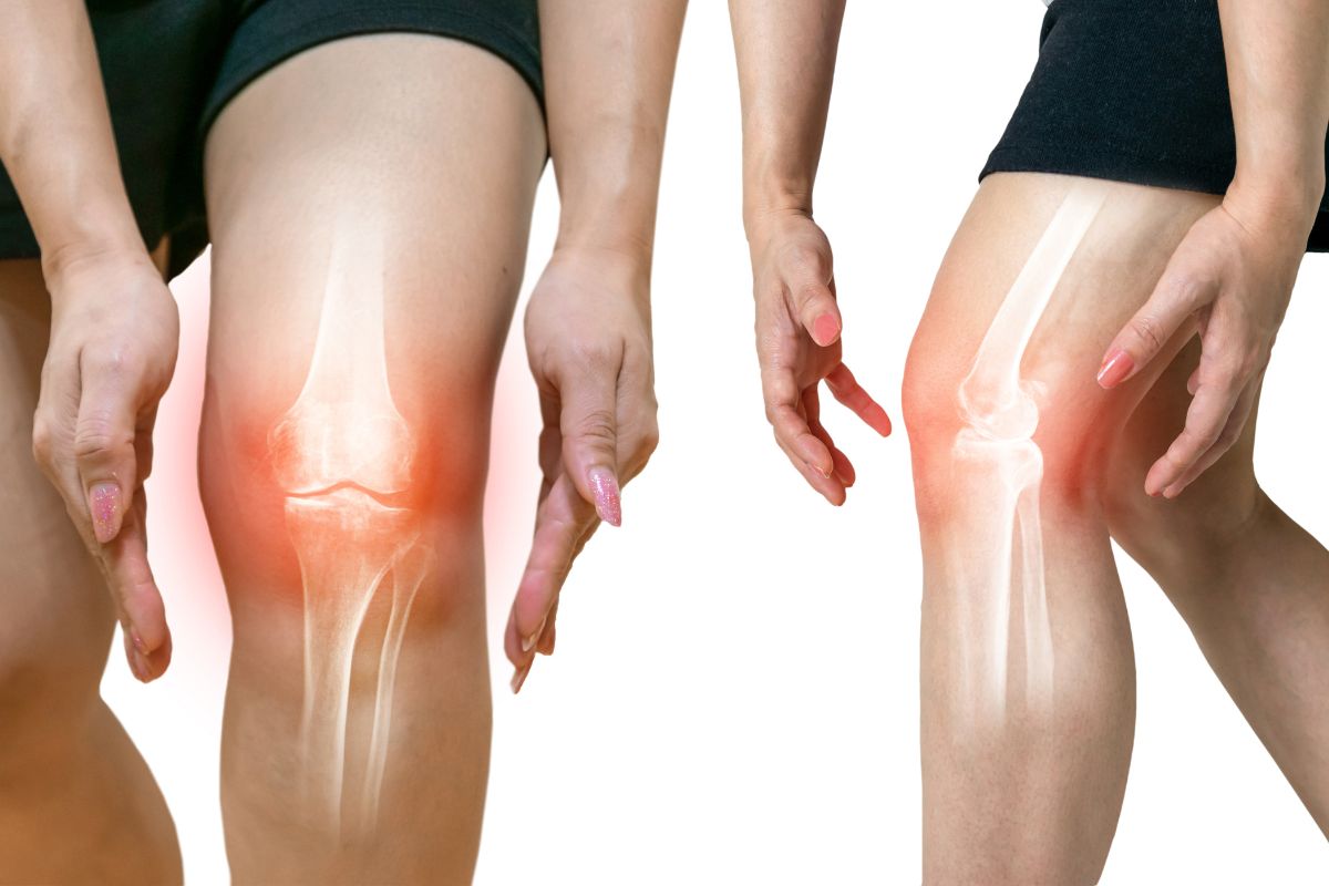गुडघ्याच्या जुनाट ऑस्टिओआर्थ्रायटिसचा त्रास सर्जरीशिवाय कमी होऊ शकतो का? वाचा तज्ज्ञांचं मत