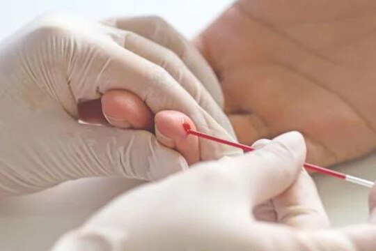 वयाच्या 45व्या वर्षानंतर महिलांना जाणवते हिमोग्लोबीनची कमतरता; काय आहेत कारणं आणि उपाय?