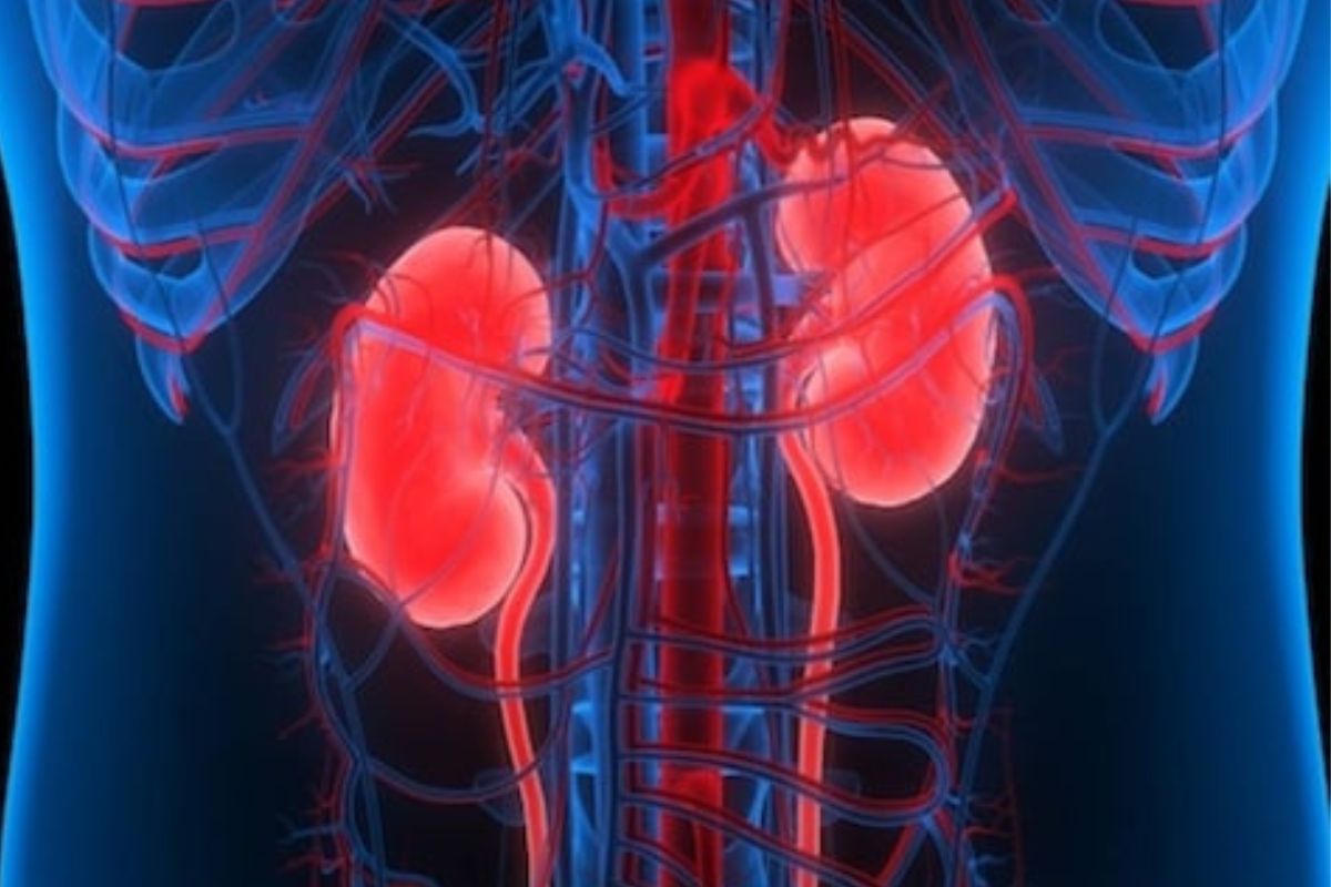 हुंड्यावरून सतत व्हायचा वाद; पत्नीला कळू न देता पतीने तिची किडनीच विकली, 4 वर्षांनी खुलासा