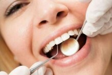 दातांतील प्लाक काढण्यासाठी करा हे सोपे उपाय, पडणार नाही खर्चिक उपचारांची गरज