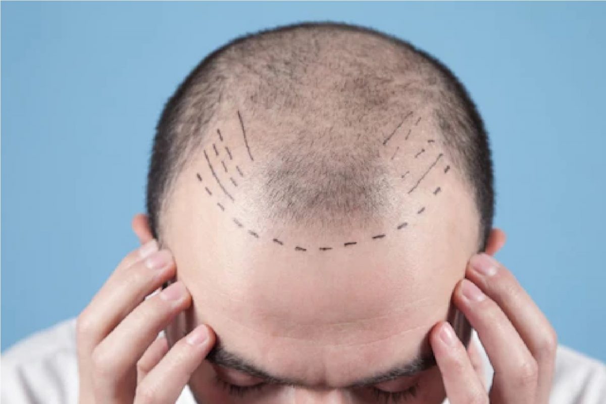 प्रतीकात्मक फोटो.