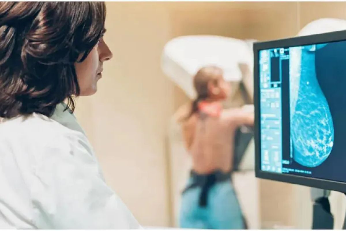 ब्रेस्ट कॅन्सर