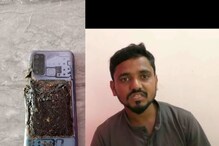 चालता चालता खिशात ठेवलेल्या मोबाइलने घेतला पेट, अंकितच्या पायाला जबर दुखापत चालता चालता खिशात ठेवलेल्या मोबाइलने घेतला पेट, अंकितच्या पायाला जबर दुखापत