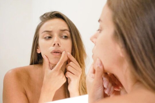 Period Pimple : पीरिअड्ससोबत पिंपल्सही का येतात? कारणासोबत यांना गायब करण्याचा फॉर्म्युलाही पाहा