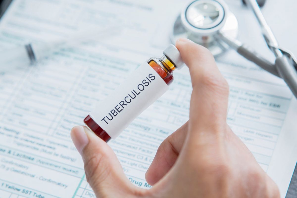 मुंबईत टीबी रुग्णांमध्ये वाढ