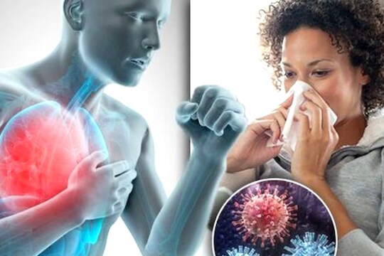 Influenza