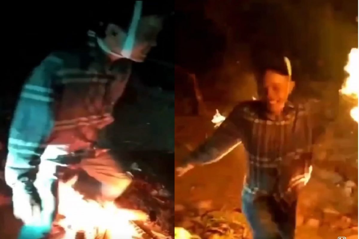 आगीशी खेळताना तरुण पेटला.