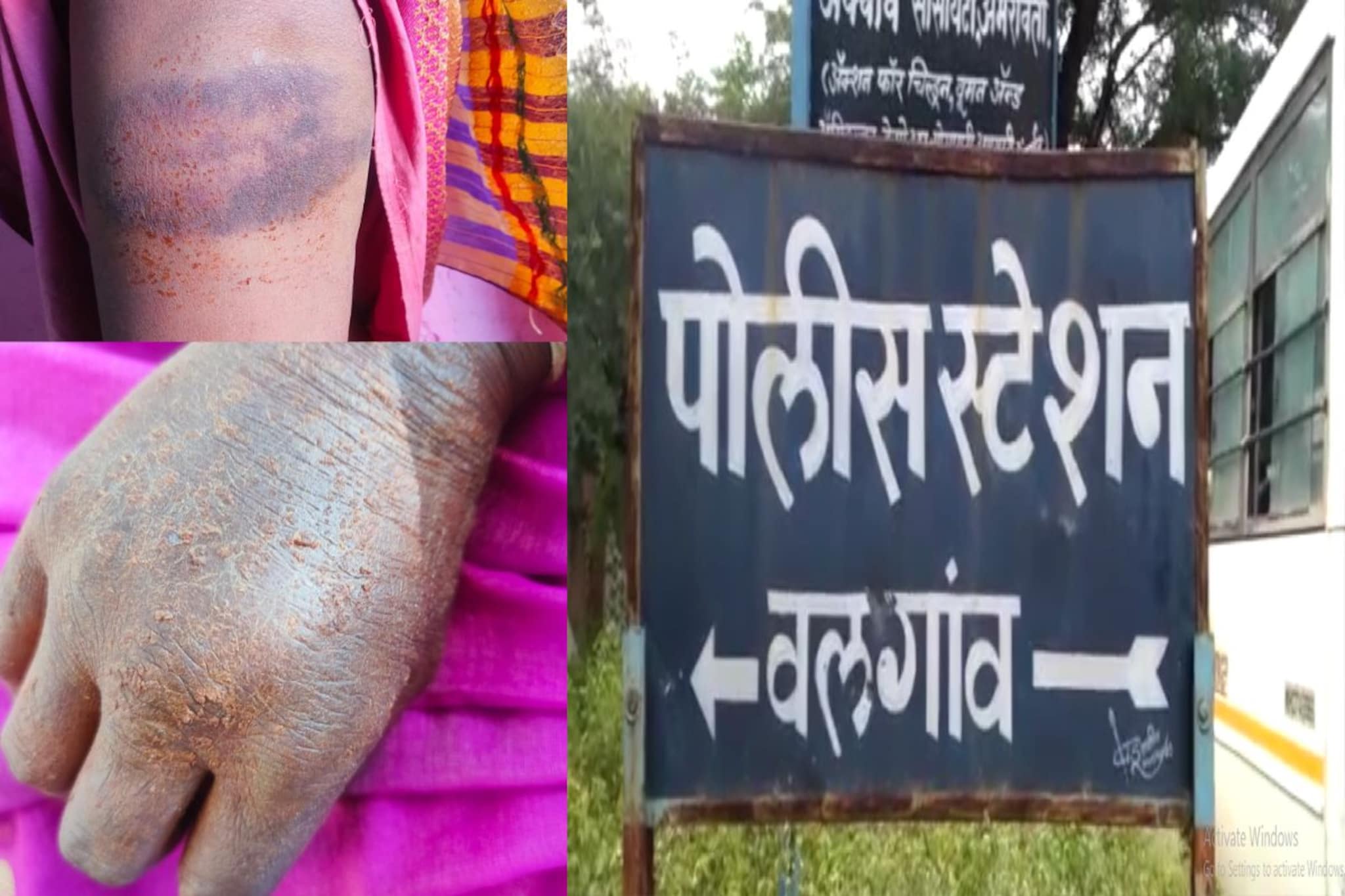 नवनीत राणांच्या अमरावतीत अपंग महिला शेतकऱ्याला निवृत्त पोलिसाकडून मारहाण