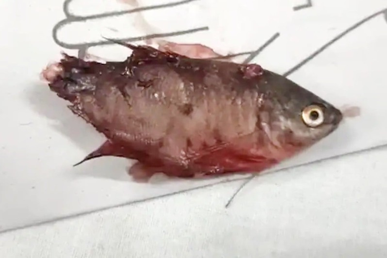 Thane : आईची नजर चुकली अन् अनर्थ घडला, चिमुकल्याच्या घशात मासा अडकून मृत्यू