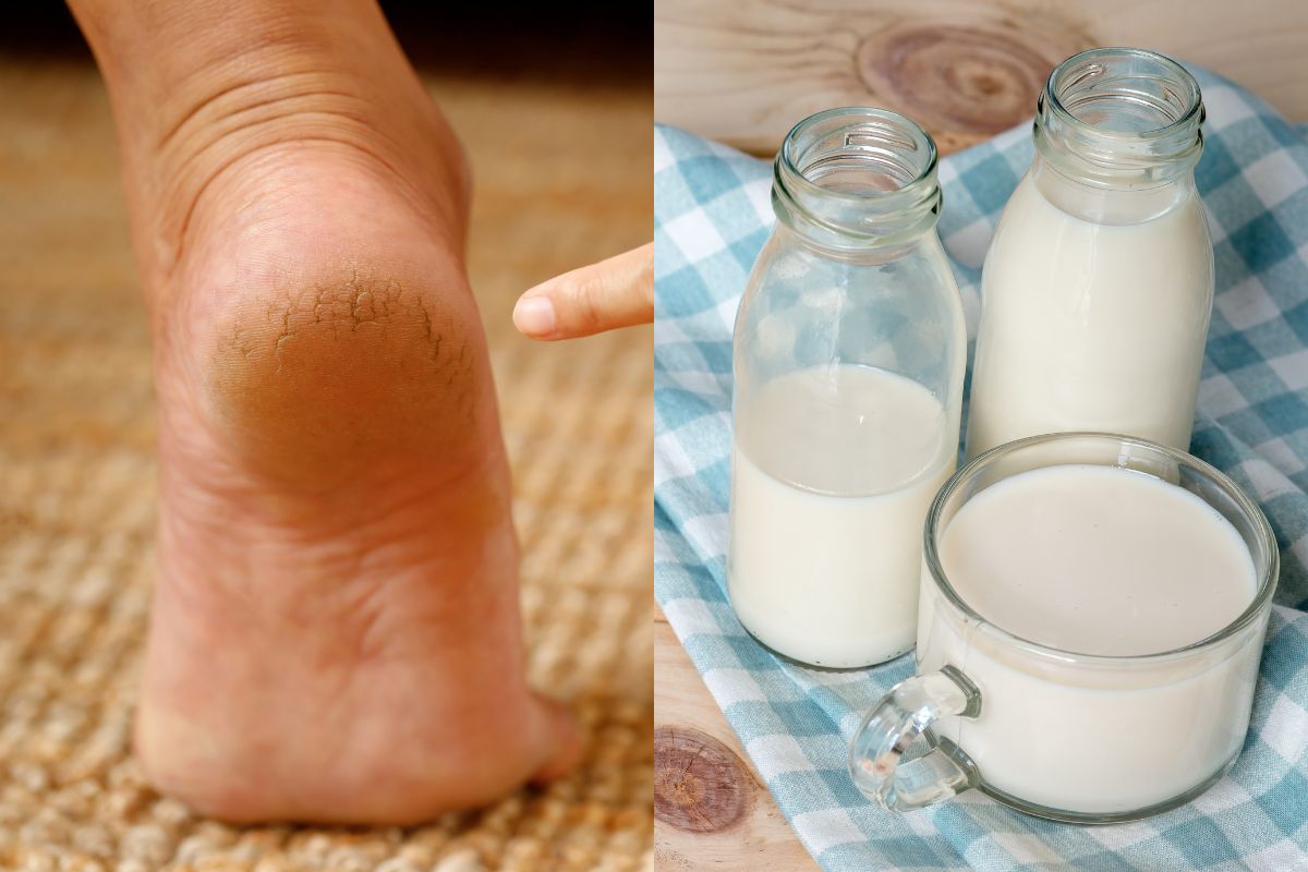 फक्त एक कप दुधाने दूर होतील टाचांवरील भेगा, रात्रीच्यावेळी असा करा वापर