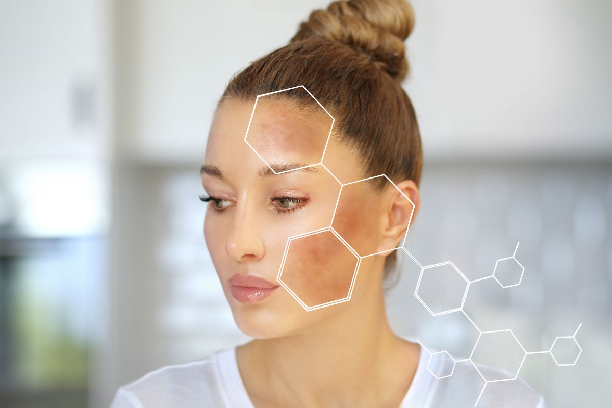 डिलिव्हरीनंतर चेहऱ्यावर काळे डाग आलेत? चिंता सोडा, करा एक्स्पर्स्टसने सांगितलेले हे उपाय