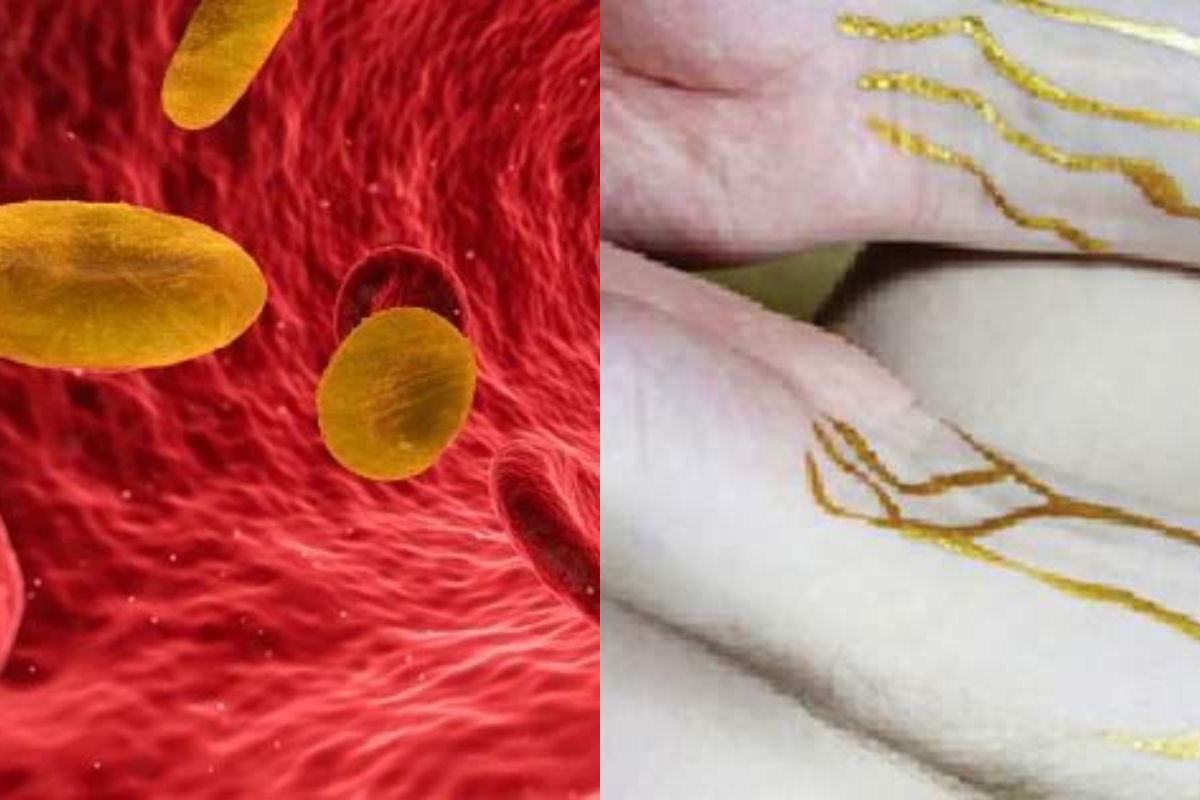 दुर्मीळ रक्तगट