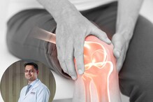 ऑपरेशनशिवाय बरा होईल Knee Arthritis; या आहेत उपचारांच्या पद्धती