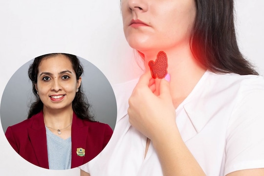 थायरॉईडच्या समस्येत उपयुक्त पदार्थ.