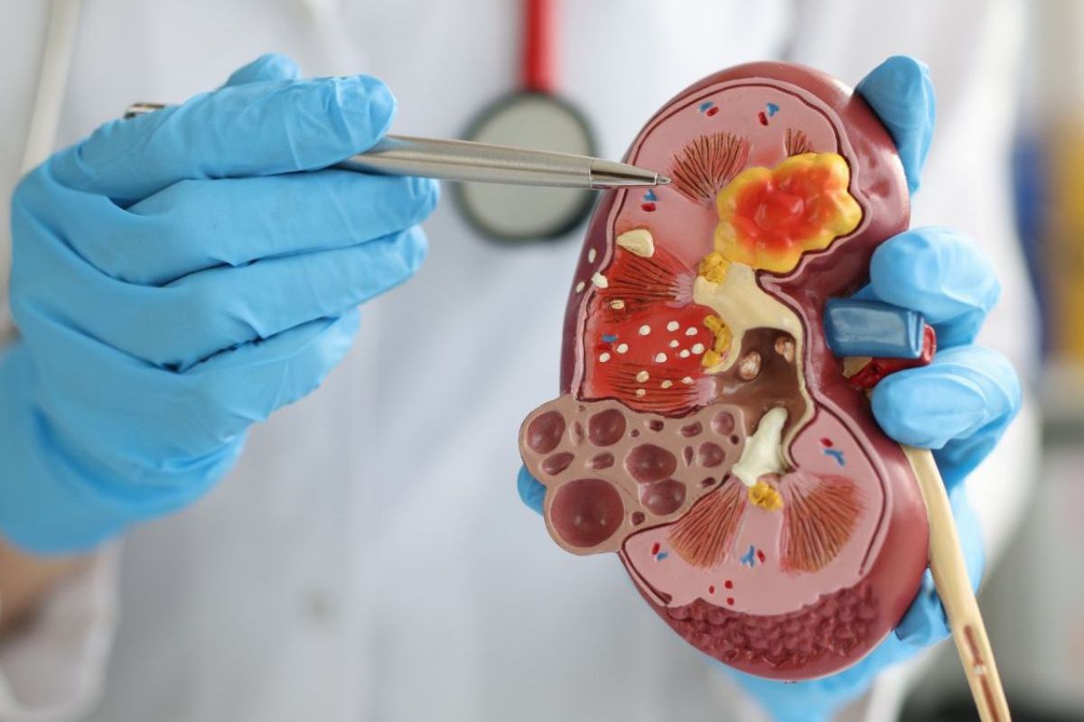 डाबिटिक किडनी डिजीज