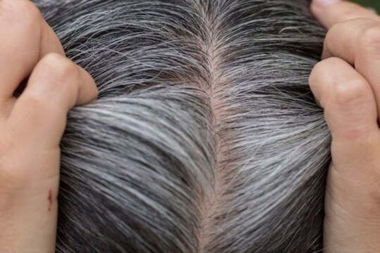 पांढऱ्या केसांसाठी करा हे स्वस्त आणि प्रभावी घरगुती उपाय