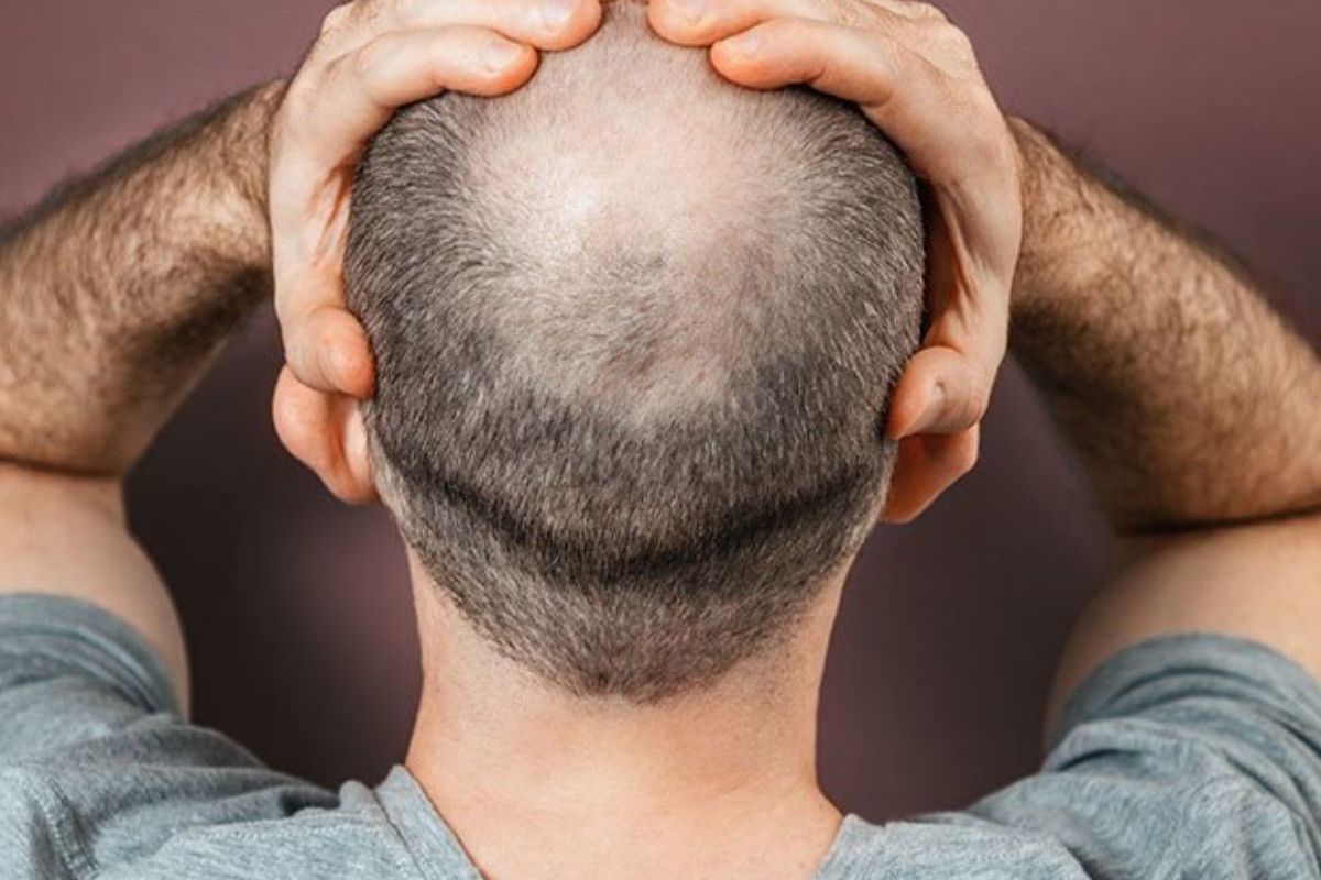 प्रतिकात्मक फोटो