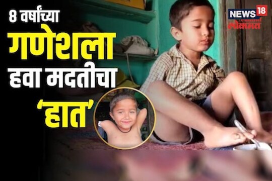 जन्मापासून पायच बनलेत 'हात'! नंदुरबारच्या 8 वर्षीय गणेशला हवा मदतीचा हात!