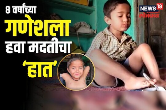 जन्मापासून पायच बनलेत 'हात'! 