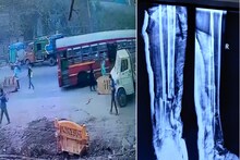 अंगावर शहारे आणणारा VIDEO, महिलेच्या अंगावरून गेली बस, ठाण्यातील घटना